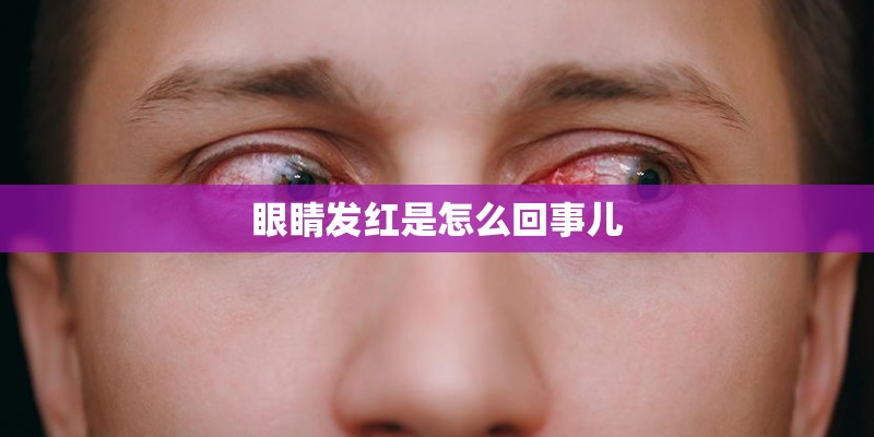 眼睛发红是怎么回事儿