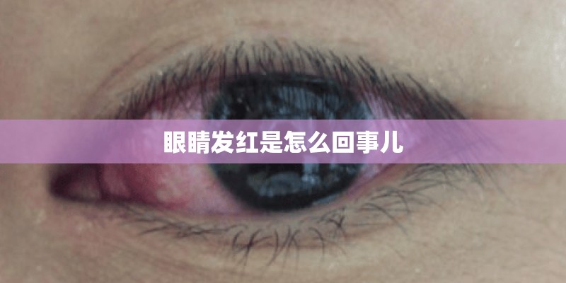 眼睛发红是怎么回事儿