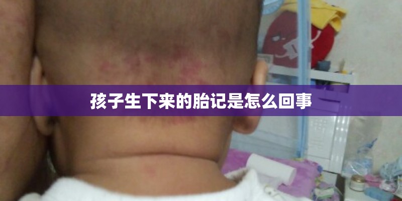 孩子生下来的胎记是怎么回事