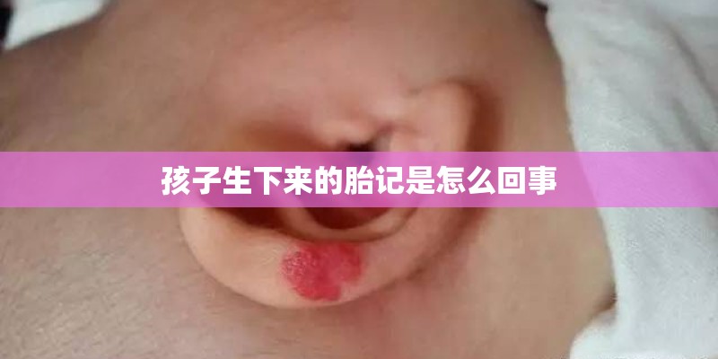 孩子生下来的胎记是怎么回事